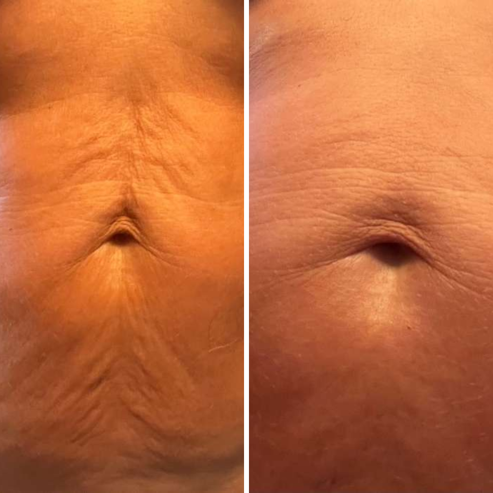 Luxury Body Oil