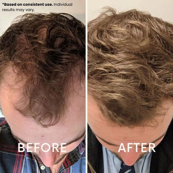Main image for Nivo FollicRevive is built so you can support your hair while you live your life, not reorganize it. Every detail is designed to help you stay consistent, feel