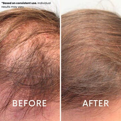 Nivo FollicRevive Red Light Hat