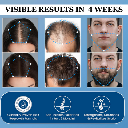 FollicLift™ Hair Growth Roll-On Serum 33
