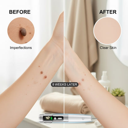 Livra Plasma Mole & Spot Remover Pen