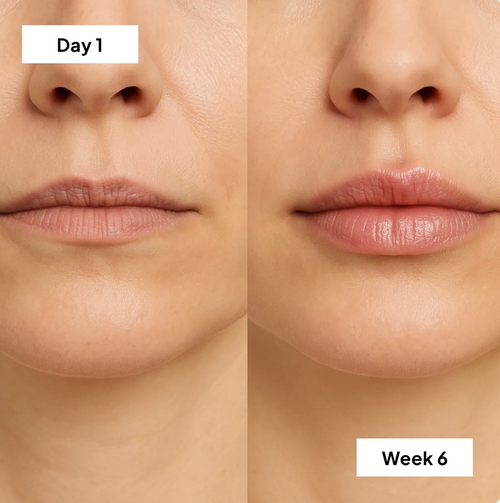 Pout Perfection Pro Kit