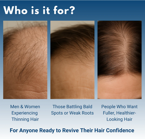 FollicLift™ Hair Growth Roll-On Serum