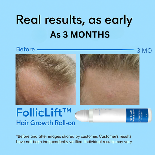FollicLift™ Hair Growth Serum