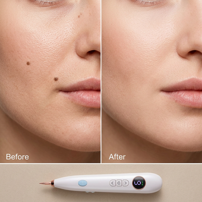 NIVO Plasma Pen
