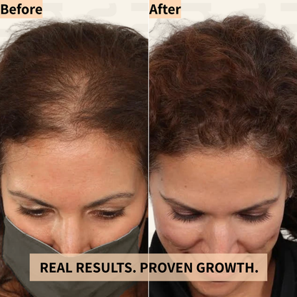Red Light Therapy hair Regrowth Cap Hat